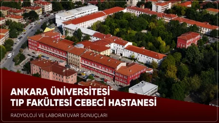 Ankara Üniversitesi Tıp Fakültesi Cebeci Hastanesi