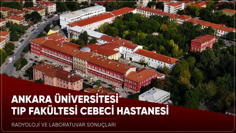 Ankara Üniversitesi Tıp Fakültesi Cebeci Hastanesi